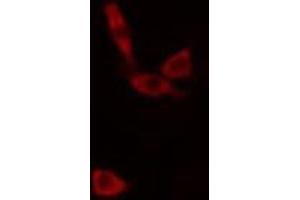 ABIN6266813 staining K-562 cells by IF/ICC. (AGPAT9 antibody  (Internal Region))