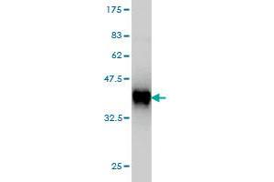 Western Blot detection against Immunogen (35. (TIMM8A/DDP antibody  (AA 9-97))