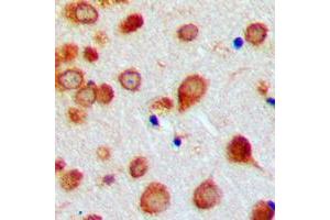Immunohistochemical analysis of BMP7 staining in human brain formalin fixed paraffin embedded tissue section. (BMP7 antibody  (Center))