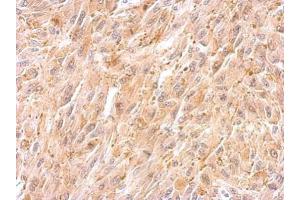IHC-P Image BCL2L12 antibody detects BCL2L12 protein at cytosol on U87 xenograft by immunohistochemical analysis. (BCL2L12 antibody  (C-Term))