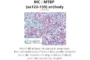 Image no. 2 for anti-MDM2 Binding Protein (MTBP) (AA 122-139) antibody (ABIN1737106)
