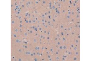 Figure. (ICA1 antibody  (AA 1-257))