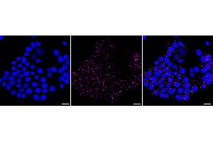 Immunocytochemical staining of HeLa cells with ERK5 antibody (ABIN7799456), 1:1,000). (Recombinant MAPK7 antibody)