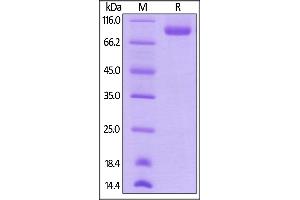 SDS-PAGE (SDS) image for Neuropilin 1 (NRP1) (AA 22-644) (Active) protein (His tag,AVI tag,Biotin) (ABIN5674605)
