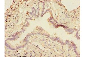 Immunohistochemistry of paraffin-embedded human lung tissue using ABIN7160270 at dilution of 1:100 (DCP1A antibody  (AA 303-582))