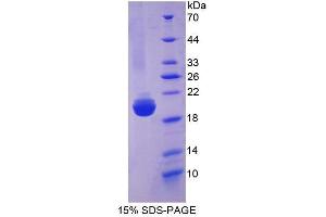 SDS-PAGE (SDS) image for Slit Homolog 2 (Drosophila) (SLIT2) (AA 1160-1333) protein (His tag) (ABIN1171383)