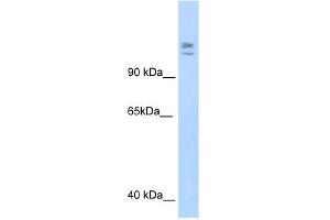 WB Suggested Anti-MYBBP1A Antibody Titration:  1.