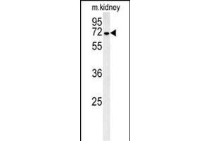 GNE Antibody (C-term) (ABIN651511 and ABIN2840271) western blot analysis in mouse kidney tissue lysates (35 μg/lane). (GNE antibody  (C-Term))