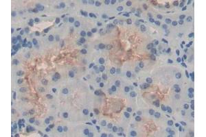 DAB staining on IHC-P; Samples: Human Kidney Tissue (HSPH1 antibody  (AA 595-733))