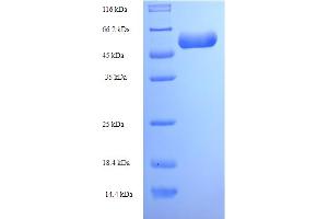 SDS-PAGE (SDS) image for NCAP (AA 1-450), (full length) protein (His tag) (ABIN5710786) (NCAP (AA 1-450), (full length) protein (His tag))