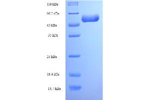 SDS-PAGE (SDS) image for NCAP (AA 1-450), (full length) protein (His tag) (ABIN5710786)
