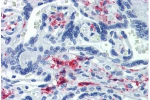 Placenta, Human: Formalin-Fixed, Paraffin-Embedded (FFPE) (CD163 antibody)