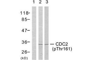 Western blot analysis of extracts from COLO205 cells (Lane 1 and 2) and K562 cells (Lane 3), using CDC2 (phospho-Thr161) antibody (E011134). (CDK1 antibody  (pThr161))