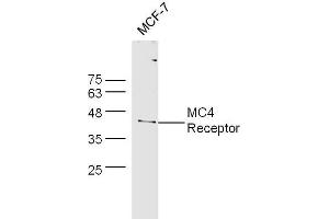 MCF-7 cell lysates probed with Rabbit Anti-MC4 Receptor Polyclonal Antibody, Unconjugated  at 1:500 for 90 min at 37˚C. (MC4R antibody  (AA 1-50))