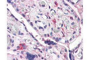 Anti-CD26 antibody IHC of human placenta. (DPP4 antibody  (Internal Region))