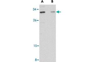Western blot analysis of GRTP1 in SK-N-SH cell lysate with GRTP1 polyclonal antibody  at 1 ug/mL in the (A) absence and (B) presence of blocking peptide.