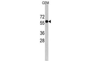 Image no. 1 for anti-CCR4-NOT Transcription Complex Subunit 4 (CNOT4) (C-Term) antibody (ABIN356969) (CNOT4 antibody  (C-Term))
