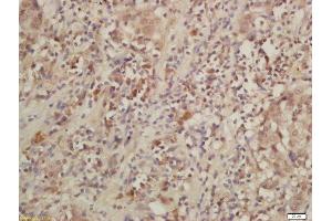 IL28RA antibody  (AA 51-150)