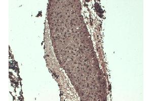 Immunohistochemistry analysis using Mouse Anti-Sodium Iodide Symporter Monoclonal Antibody, Clone 14F . (SLC5A5 antibody  (AA 468-643))