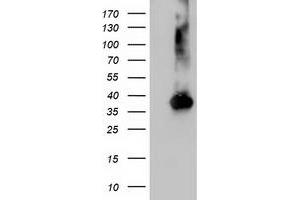 Western Blotting (WB) image for anti-Nudix (Nucleoside Diphosphate Linked Moiety X)-Type Motif 18 (NUDT18) antibody (ABIN1499861) (NUDT18 antibody)