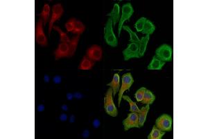 ABIN6256168 and ABIN6267171 staining Hela cells(heat shock treatment) by IF/ICC.