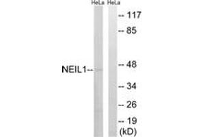 Western blot analysis of extracts from HeLa cells, using NEIL1 Antibody.