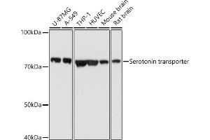 Western blot analysis of extracts of various cell lines, using Serotonin transporter antibody (ABIN7270477) at 1:1000 dilution. (SLC6A4 antibody  (C-Term))