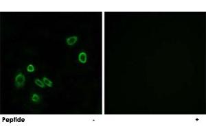 Immunofluorescence analysis of A-549 cells, using BRP44L polyclonal antibody .