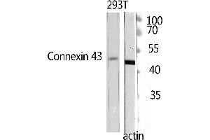 Western Blotting (WB) image for anti-Doublecortin (DCX) (Ser30) antibody (ABIN3184352) (Doublecortin antibody  (Ser30))