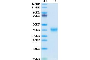 Mouse CLEC10A on Tris-Bis PAGE under reduced condition. (CLEC10A Protein (AA 57-304) (His tag))