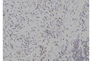 ABIN6277285 at 1/100 staining Human gastric tissue by IHC-P. (TBK1 antibody  (Internal Region))