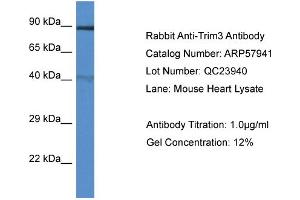 Western Blotting (WB) image for anti-Tripartite Motif Containing 3 (TRIM3) (N-Term) antibody (ABIN2787468) (TRIM3 antibody  (N-Term))
