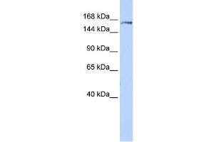 EPRS antibody used at 1 ug/ml to detect target protein. (EPRS antibody  (Middle Region))
