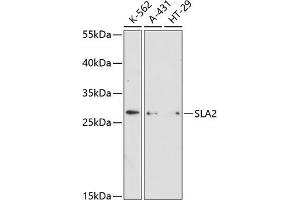 Western blot analysis of extracts of various cell lines, using SL antibody (ABIN6130692, ABIN6147825, ABIN6147826 and ABIN6216581) at 1:3000 dilution. (SLAP2 antibody  (AA 1-160))