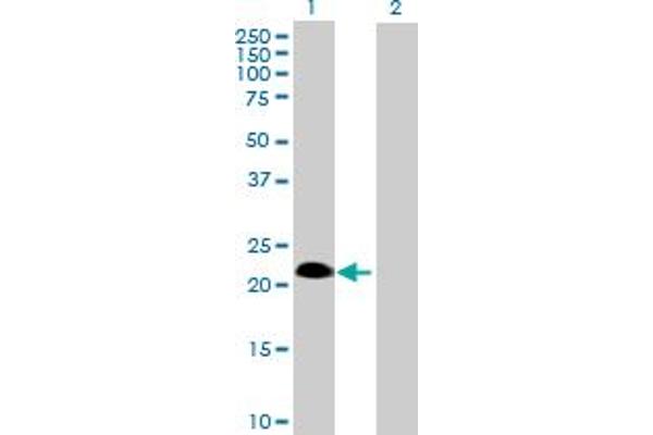 SSPN antibody  (AA 1-243)