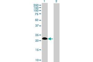 Western Blot analysis of SSPN expression in transfected 293T cell line by SSPN MaxPab polyclonal antibody.