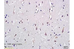 Formalin-fixed and paraffin embedded rat brain tissue labeled with Anti-CD203c Polyclonal Antibody, Unconjugated (ABIN731453) followed by conjugation to the secondary antibody and DAB staining (ENPP3 antibody  (AA 40-140))
