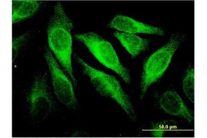 Immunofluorescence of monoclonal antibody to CEACAM6 on HeLa cell. (CEACAM6 antibody  (AA 156-265))