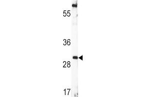 Western Blotting (WB) image for anti-Brain-Derived Neurotrophic Factor (BDNF) antibody (ABIN3003616)