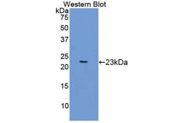 Gastrokine 2 antibody  (AA 21-184)