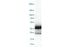 Western Blot analysis of RT-4 cell lysate with EMD monoclonal antibody, clone CL0203 .