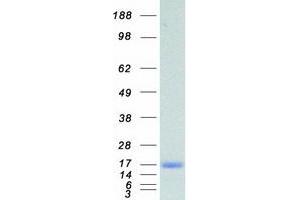Validation with Western Blot (FABP5 Protein (Myc-DYKDDDDK Tag))