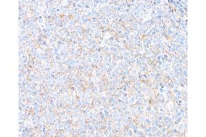 Immunohistochemistry (IHC) image for anti-Hepatitis A Virus Cellular Receptor 2 (TIM 3) (AA 22-201) antibody (ABIN7449550)