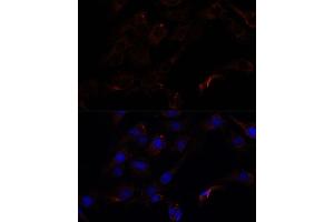 Immunofluorescence analysis of C6 cells using 43716 antibody (ABIN7265350) at dilution of 1:100. (Septin 8 antibody  (AA 348-427))