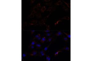 Immunofluorescence analysis of C6 cells using 43716 antibody (ABIN7265350) at dilution of 1:100. (Septin 8 antibody  (AA 348-427))