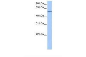 Image no. 1 for anti-Sema Domain, Transmembrane Domain (TM), and Cytoplasmic Domain, (Semaphorin) 6D (SEMA6D) (AA 21-70) antibody (ABIN6738580) (SEMA6D antibody  (AA 21-70))