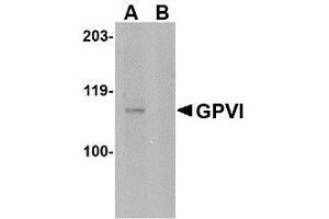 Western blot analysis of GPVI in A-20 lysate with AP30379PU-N GPVI antibody at 1μg/ml in either the absence or (B) the presence of blocking peptide.