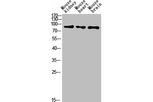 MUM1 Antikörper  (AA 661-710)