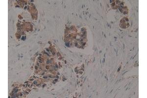 Used in DAB staining on fromalin fixed paraffin- embedded kidney tissue (KRT16 antibody  (AA 117-419))