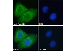 ABIN571180 Immunofluorescence analysis of paraformaldehyde fixed A549 cells, permeabilized with 0. (PLA2G4A antibody  (Internal Region))